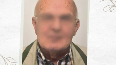 a man with no hair